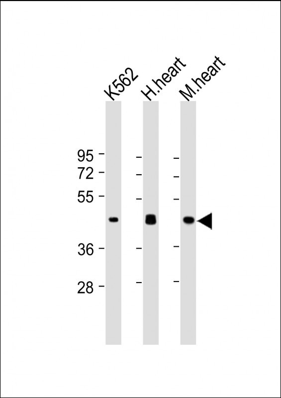 All lanes : Anti-PDK4 Antibody at 1:500-1:1000 dilutionLane 1: K562 whole cell lysateLane 2: Human heart lysateLane 3: Mouse heart lysateLysates/proteins at 20 µg per lane