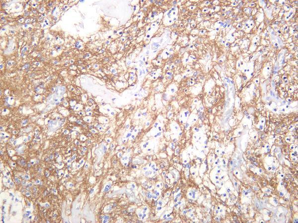 m02133 2 slc1a3 primary antibodies ihc testing 4