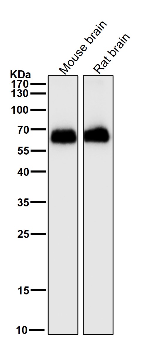 All lanes use the Antibody at 1:2K dilution for 1 hour at room temperature