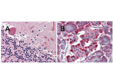 m02134 lgr4 primary antibodies ihc testing 1