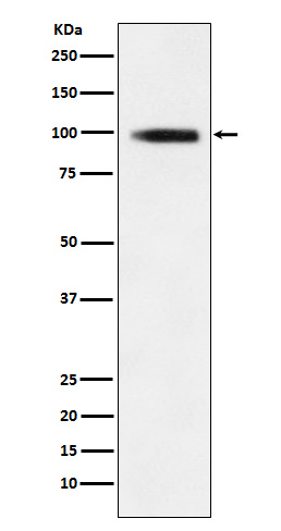 Western blot analysis of GIT1 expression in 293T cell lysate