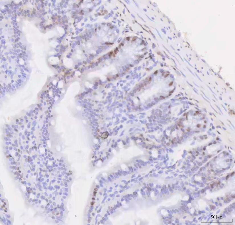 m02148 smc1 primary antibodies ihc testing 1