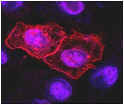 Immunocytochemistry staining (confocal microscopy) of HeLa human cervix carcinoma cell line transfected with TRAIL-R1 expression plasmid using anti-human TRAIL-R1 (DR-4-02)