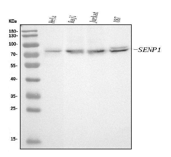  Western blot analysis of SENP1 using anti-SENP1 antibody (M02156-1)