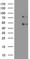 HEK293T cells were transfected with the pCMV6-ENTRY control (Left lane) or pCMV6-ENTRY SENP1 (Right lane) cDNA for 48 hrs and lysed