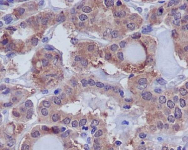 Immunohistochemical analysis of paraffin-embedded human thyroid, using DUSP6 Antibody