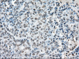 m02166 1 anti cytochrome p450 reductase por mouse monoclonal antibody clone id oti5b3 ihc testing 10