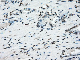 m02166 1 anti cytochrome p450 reductase por mouse monoclonal antibody clone id oti5b3 ihc testing 12