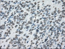 m02166 1 anti cytochrome p450 reductase por mouse monoclonal antibody clone id oti5b3 ihc testing 13