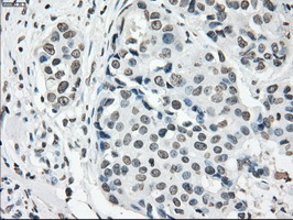 m02166 1 anti cytochrome p450 reductase por mouse monoclonal antibody clone id oti5b3 ihc testing 14