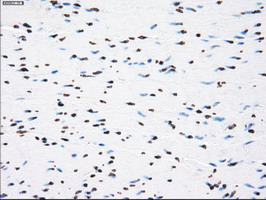m02166 1 anti cytochrome p450 reductase por mouse monoclonal antibody clone id oti5b3 ihc testing 15