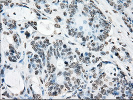m02166 1 anti cytochrome p450 reductase por mouse monoclonal antibody clone id oti5b3 ihc testing 16