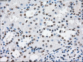 m02166 1 anti cytochrome p450 reductase por mouse monoclonal antibody clone id oti5b3 ihc testing 17