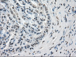 m02166 1 anti cytochrome p450 reductase por mouse monoclonal antibody clone id oti5b3 ihc testing 18