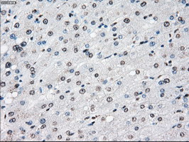 m02166 1 anti cytochrome p450 reductase por mouse monoclonal antibody clone id oti5b3 ihc testing 19