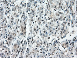 m02166 1 anti cytochrome p450 reductase por mouse monoclonal antibody clone id oti5b3 ihc testing 20