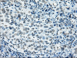 m02166 1 anti cytochrome p450 reductase por mouse monoclonal antibody clone id oti5b3 ihc testing 3