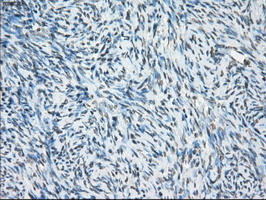 m02166 1 anti cytochrome p450 reductase por mouse monoclonal antibody clone id oti5b3 ihc testing 4