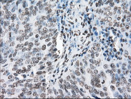 m02166 1 anti cytochrome p450 reductase por mouse monoclonal antibody clone id oti5b3 ihc testing 5