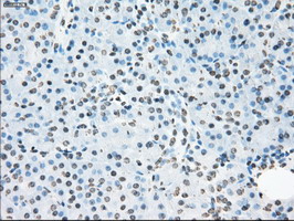 m02166 1 anti cytochrome p450 reductase por mouse monoclonal antibody clone id oti5b3 ihc testing 6