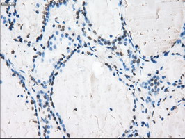 m02166 1 anti cytochrome p450 reductase por mouse monoclonal antibody clone id oti5b3 ihc testing 7