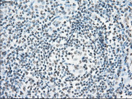 m02166 1 anti cytochrome p450 reductase por mouse monoclonal antibody clone id oti5b3 ihc testing 8