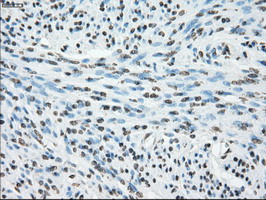 m02166 1 anti cytochrome p450 reductase por mouse monoclonal antibody clone id oti5b3 ihc testing 9