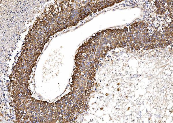  IHC analysis of POR using anti-POR antibody (M02166-2)