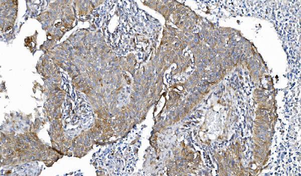 m02166 2 por primary antibodies ihc testing 4