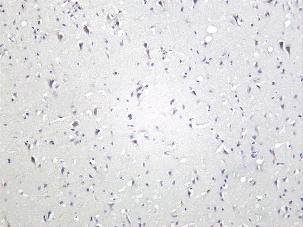 m02169 2 cdc37 primary antibodies ihc testing 1