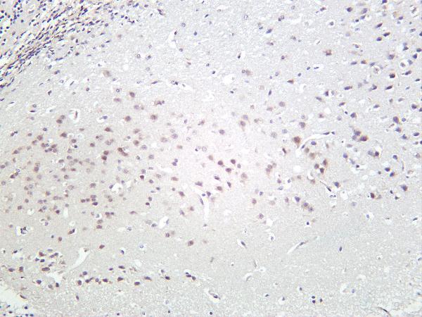 m02169 2 cdc37 primary antibodies ihc testing 2