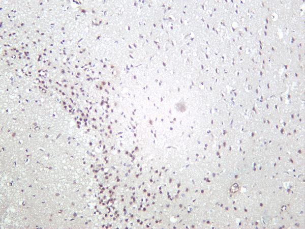 m02169 2 cdc37 primary antibodies ihc testing 3