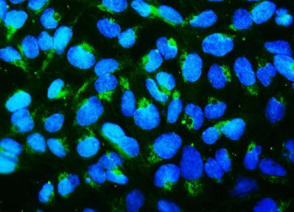  IF analysis of MFN1 using anti-MFN1 antibody (M02172-1)
