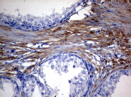 m02172 2 anti mitofusin 1 mfn1 mouse monoclonal antibody clone id oti4d11 ihc testing 4