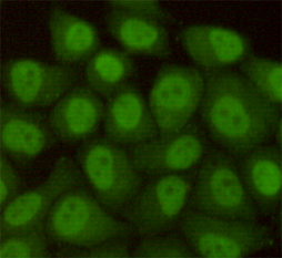 Immunocytochemistry staining of HeLa cells fixed with 4% Paraformaldehyde and using anti-Rad23B antibody (dilution 1:100)