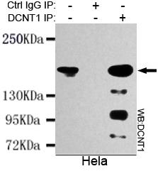 Immunoprecipitation analysis of Hela cell lysates using DCTN1 antibody