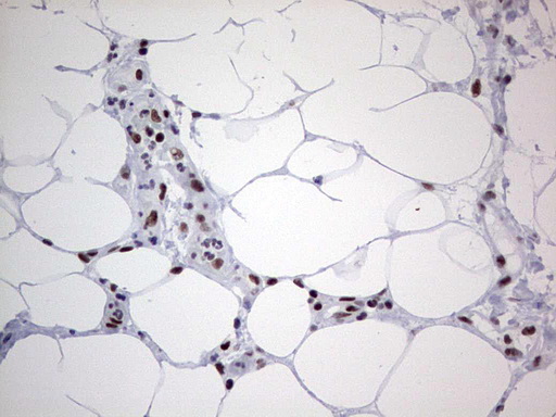 m02177 1 anti hdac9 mouse monoclonal antibody clone id oti7g2 ihc testing 13