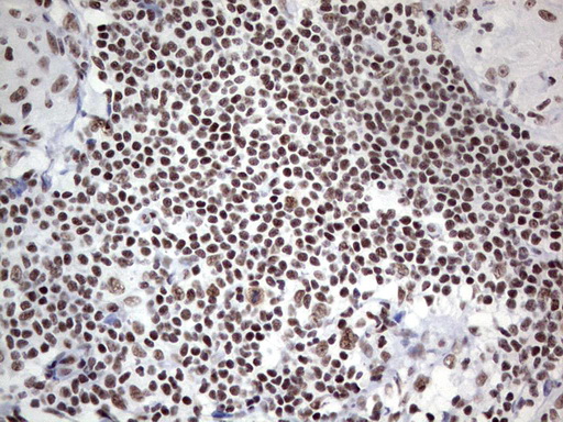 m02177 1 anti hdac9 mouse monoclonal antibody clone id oti7g2 ihc testing 14