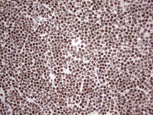 m02177 1 anti hdac9 mouse monoclonal antibody clone id oti7g2 ihc testing 15
