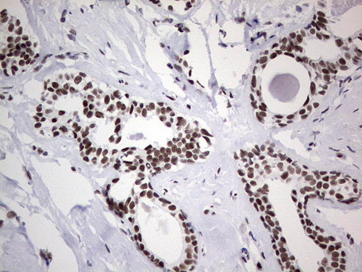 m02177 1 anti hdac9 mouse monoclonal antibody clone id oti7g2 ihc testing 16