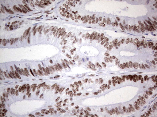 m02177 1 anti hdac9 mouse monoclonal antibody clone id oti7g2 ihc testing 17