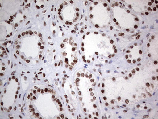 m02177 1 anti hdac9 mouse monoclonal antibody clone id oti7g2 ihc testing 19