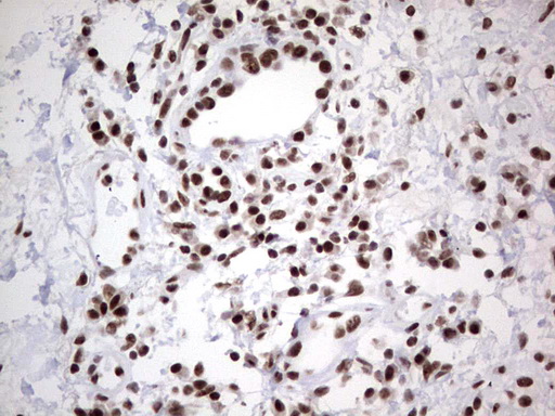 m02177 1 anti hdac9 mouse monoclonal antibody clone id oti7g2 ihc testing 2