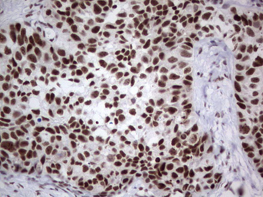 m02177 1 anti hdac9 mouse monoclonal antibody clone id oti7g2 ihc testing 20