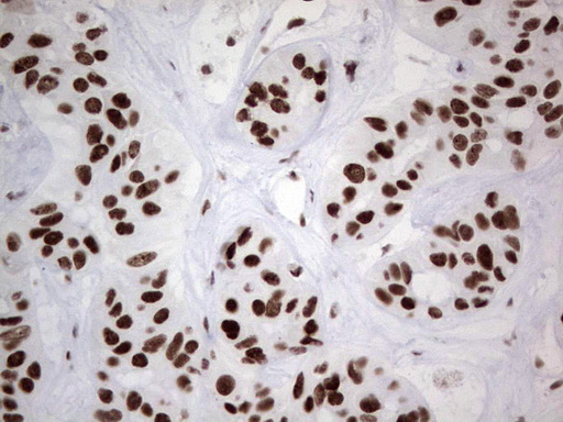 m02177 1 anti hdac9 mouse monoclonal antibody clone id oti7g2 ihc testing 21