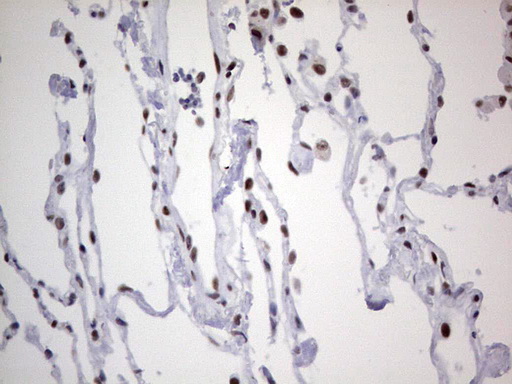 m02177 1 anti hdac9 mouse monoclonal antibody clone id oti7g2 ihc testing 22