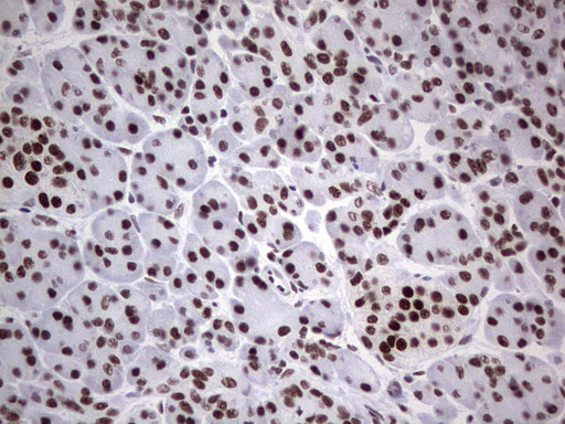 m02177 1 anti hdac9 mouse monoclonal antibody clone id oti7g2 ihc testing 5