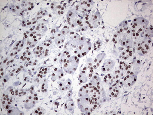 m02177 1 anti hdac9 mouse monoclonal antibody clone id oti7g2 ihc testing 6