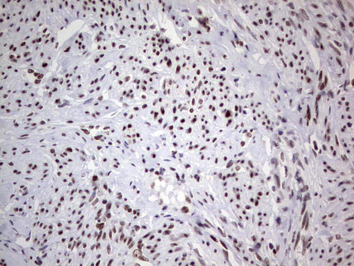 m02177 1 anti hdac9 mouse monoclonal antibody clone id oti7g2 ihc testing 8