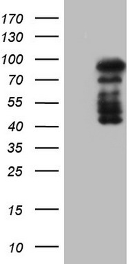 m02177 1 anti hdac9 mouse monoclonal antibody clone id oti7g2 wb testing 1
